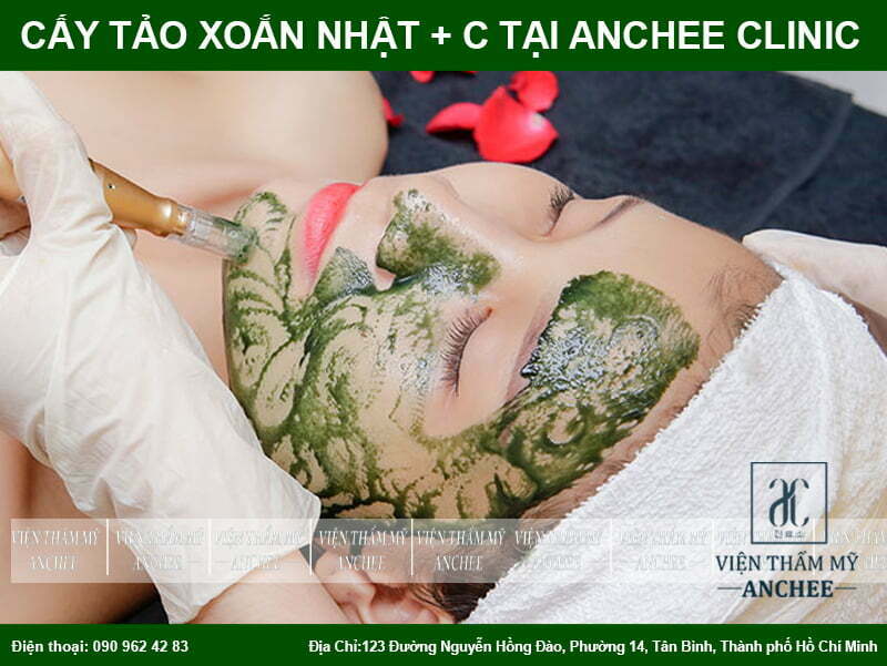 Cấy Tảo Xoắn Có Tác Dụng Gì? Quy Trình+Bảng Giá 2023