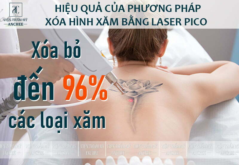 Kem Xóa Hình Xăm  Lafolly Tatto  Hanoi
