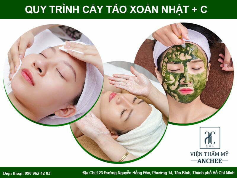 Cấy Tảo Xoắn Có Tác Dụng Gì? Quy Trình+Bảng Giá 2023