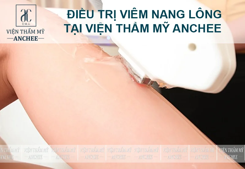 Phương pháp trị lỗ chân lông ở chân bị thâm hiệu quả, nhanh chóng tại Anchee Clinic