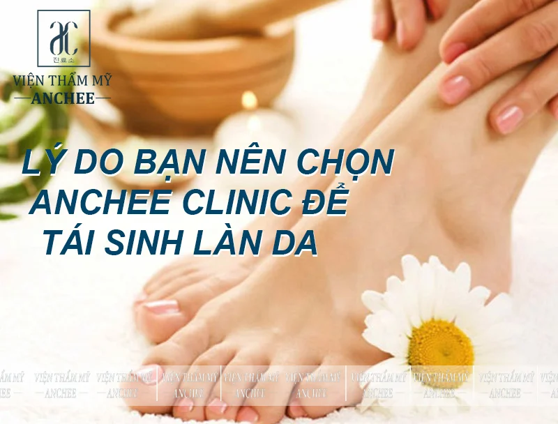 Lý do bạn nên chọn Anchee Clinic để trị thâm mắt cá chân