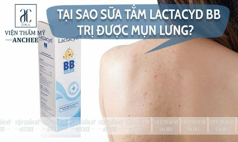 Tại sao sữa tắm Lactacyd BB trị được mụn lưng?