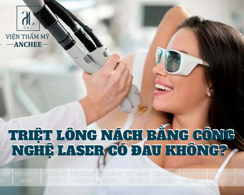 Triệt lông nách bằng công nghệ laser có đau không?