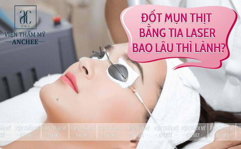 Đốt Mụn Thịt Bằng Tia Laser Bao Nhiêu Tiền? Bảng Giá #2023