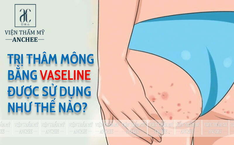 Vaseline là gì và tác dụng của nó trong việc trị thâm mông?
