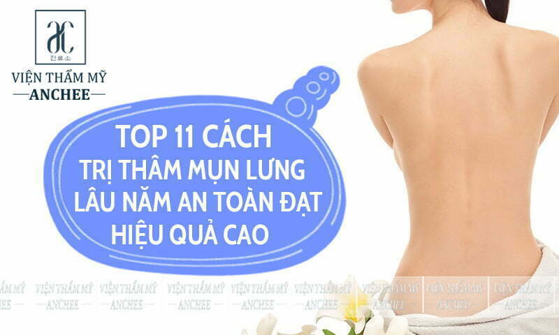 Có cần kết hợp với các phương pháp trị thâm lưng khác khi sử dụng Laser?