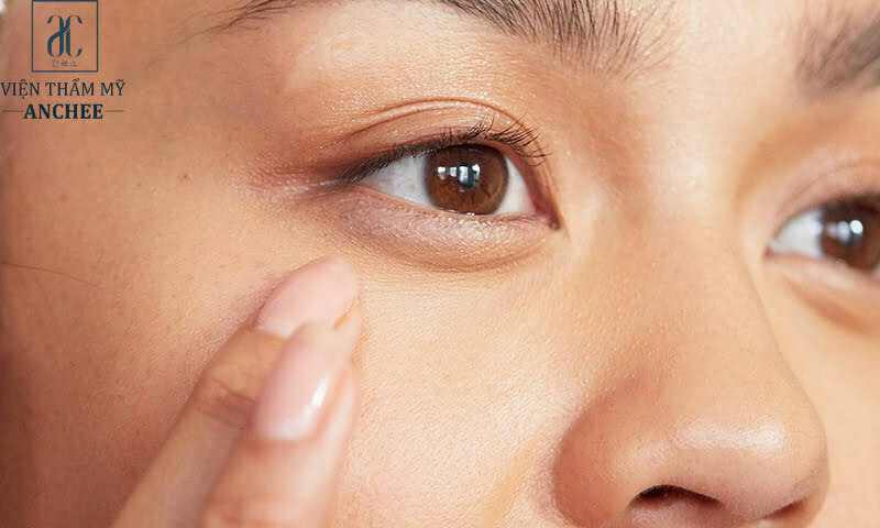 8 cách sử dụng dầu dừa trị thâm mắt hiệu quả lên tới 100%