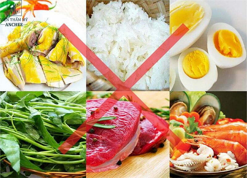 Những thực phẩm cần tránh xa khi bị mụn mủ 
