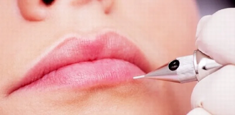 Khử thâm môi bằng laser 1 lần duy nhất - Giá bao nhiêu #2022
