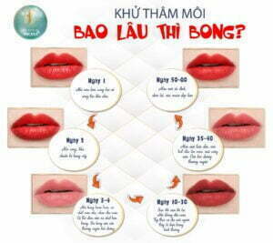 khử thâm môi bao lâu thì bong