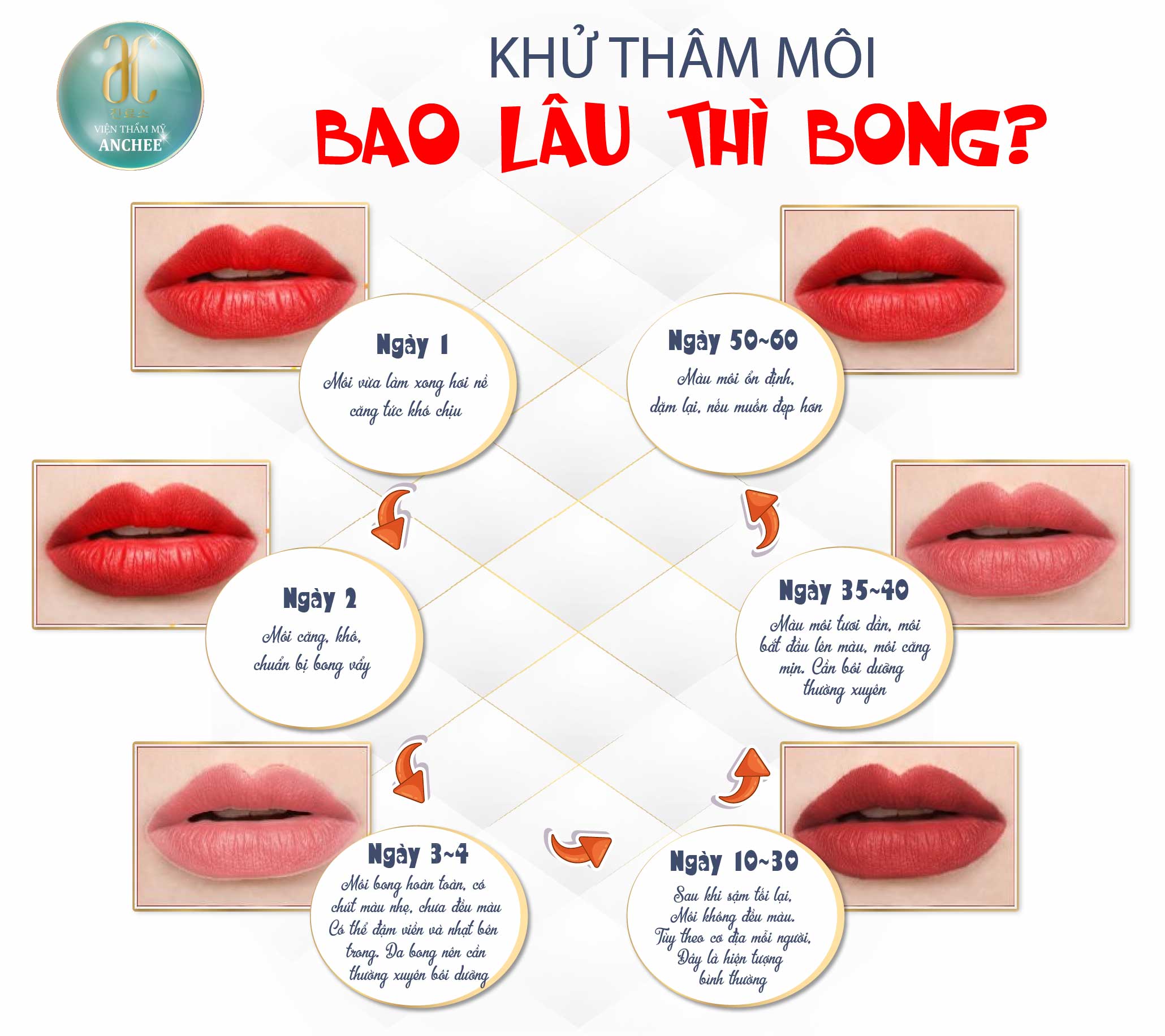 Giải đáp thắc mắc Xăm môi bao lâu thì lên màu đẹp nhất  Nhà thuốc FPT  Long Châu