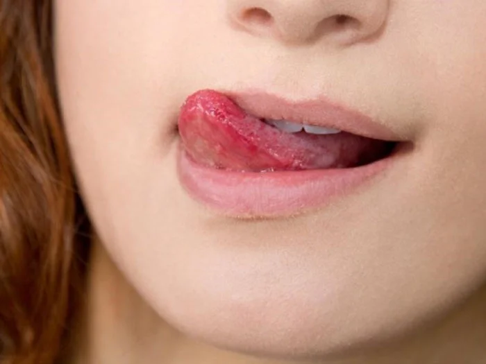 Thói quen xấu: liếm hoặc cắn môi