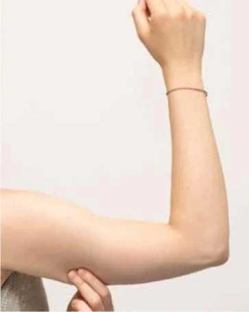 Tiêm botox bắp tay có hại không? Giữ bao lâu? Giá bao nhiêu? [2022]