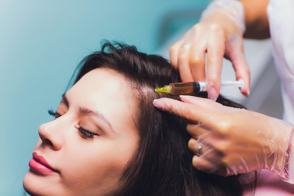 Tiêm mọc tóc bằng phương pháp Mesotherapy hiệu quả bất ngờ