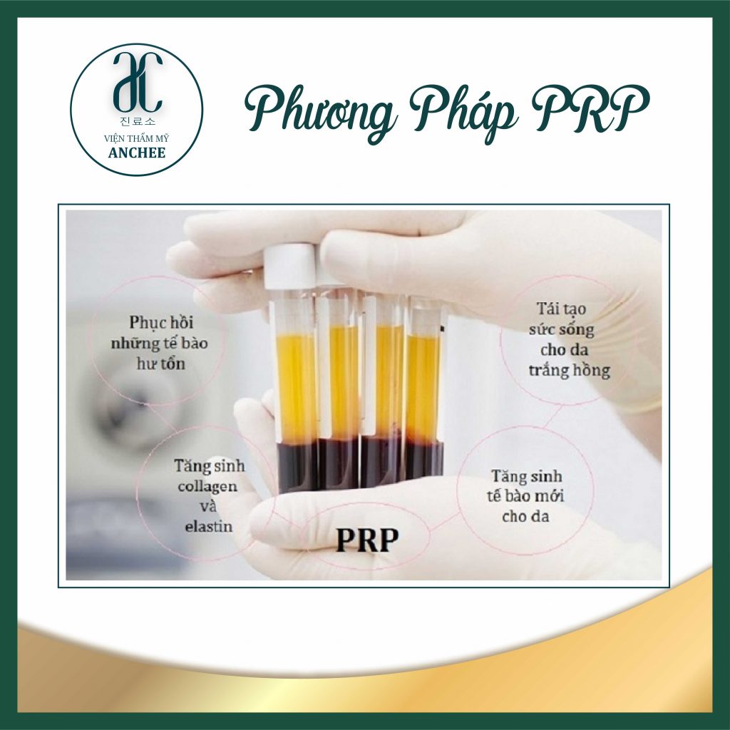 Phương pháp PRP là gì? Tác dụng và quy trình chuẩn y khoa [2022]