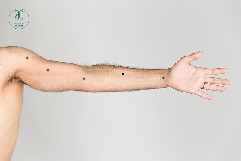 [Tử Vi] Nốt ruồi ở cánh tay trái, phải ở Nam & Nữ mang ý nghĩa gì?