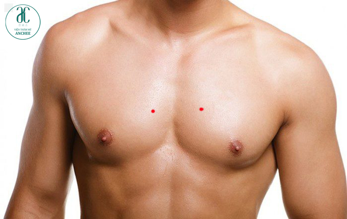 nốt ruồi son ở ngực nam giới