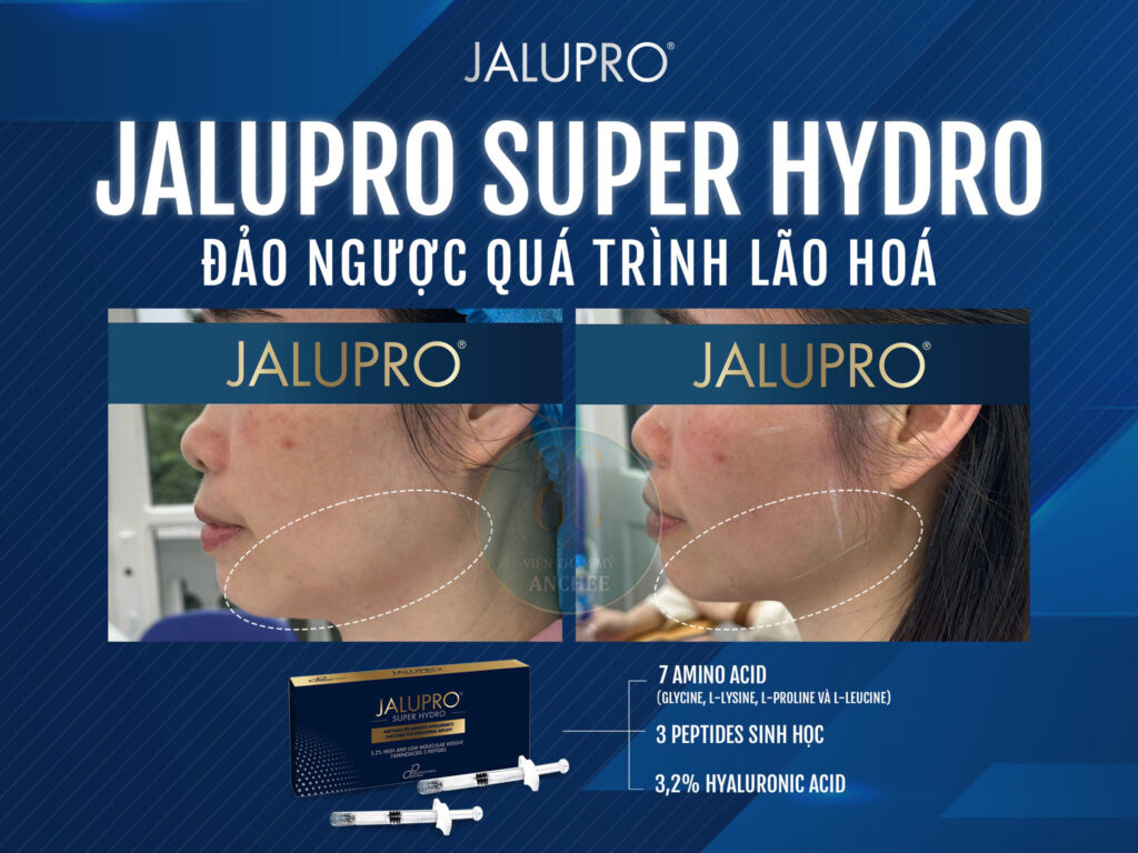 Jalupro Super Hydro - Ưu Điểm, Quy Trình & Địa Chỉ Uy Tín